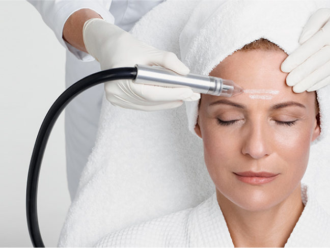 Mikrodermabrasion -